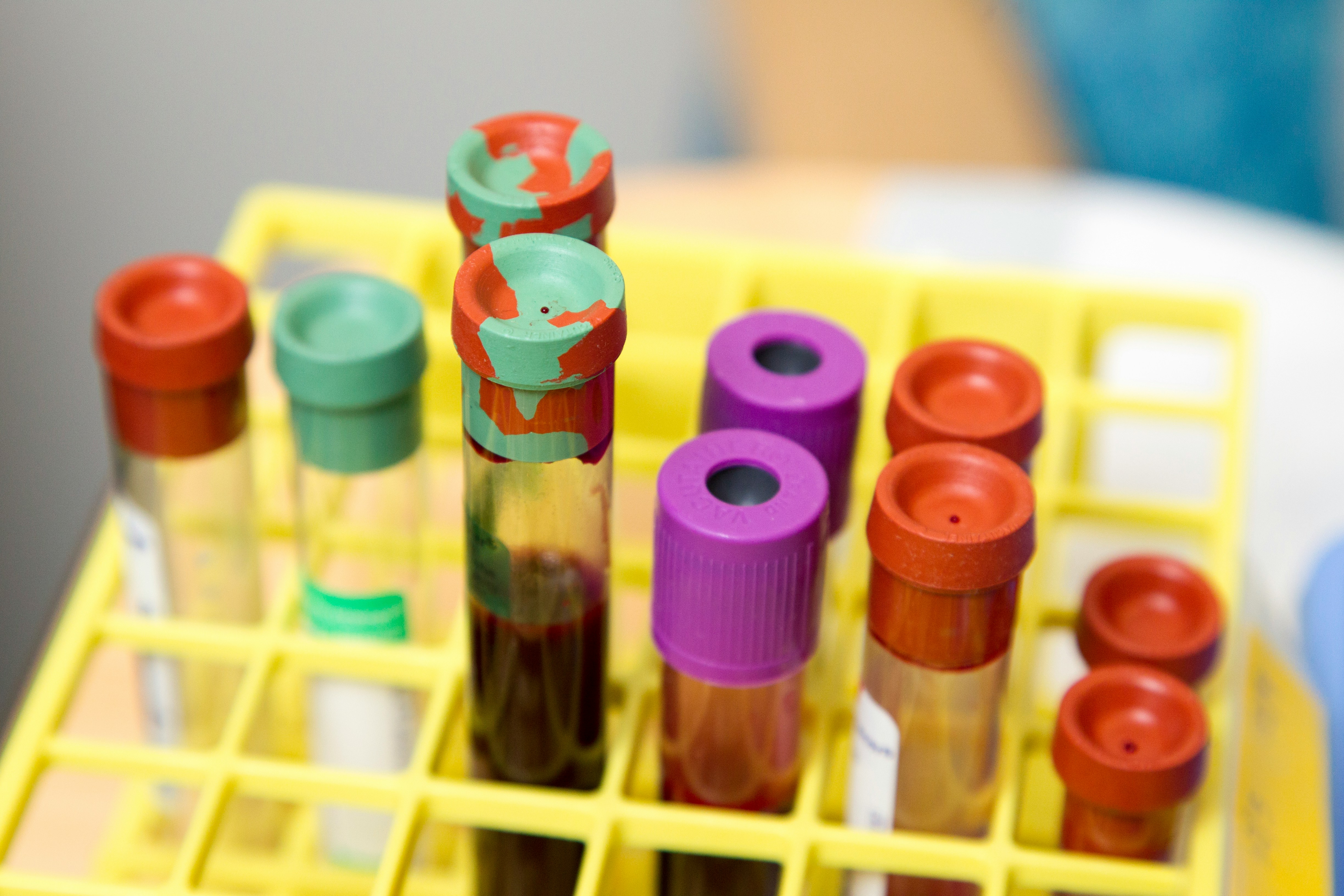 Vials of blood for blood testing