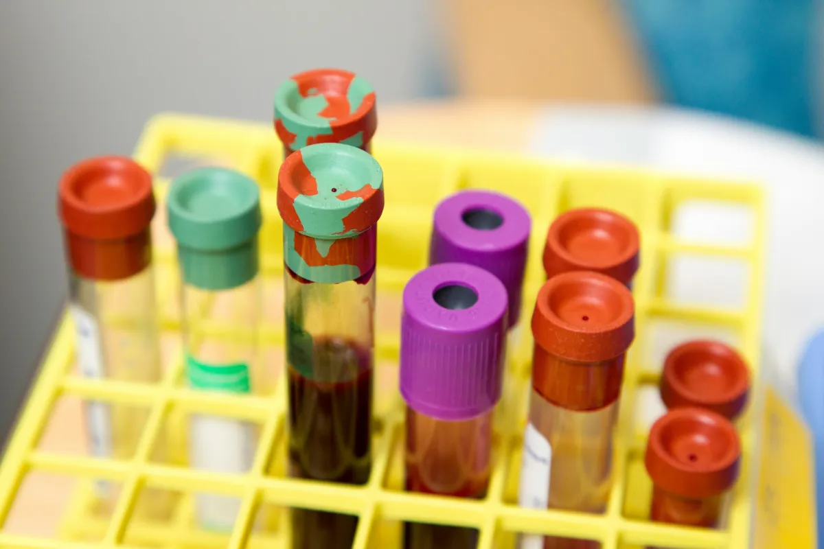 Vials of blood for blood testing